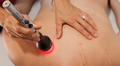 Mittels Softlaser-Therapie rege ich den Zellstoffwechsel gestörter oder veränderter Zellen wieder an. Eine gute Alternative für nadelsensible Personen.